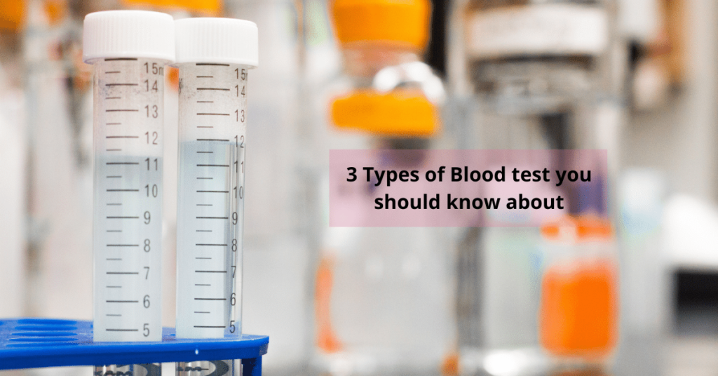 3 Types of Blood Tests You Should Know About